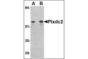 Western blot analysis of Plxdc2 in human colon tissue lysate with this product at (A) 0. (PLXDC2 antibody  (C-Term))