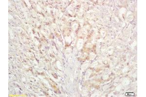 Formalin-fixed and paraffin embedded mouse stomach labeled with Anti-Bad Polyclonal Antibody, Unconjugated  at 1:200 followed by conjugation to the secondary antibody and DAB staining (BAD antibody  (AA 101-204))