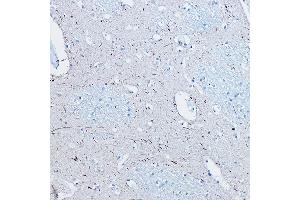 Immunohistochemistry of paraffin-embedded human brain using Phospho-Tau-S396 Rabbit mAb (ABIN7268523) at dilution of 1:100 (40x lens). (MAPT antibody  (pSer396))