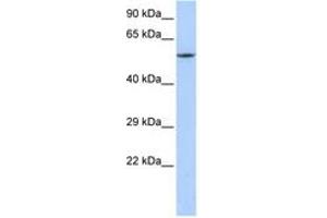 Image no. 1 for anti-Calcium Channel, Voltage-Dependent, beta 1 Subunit (CACNB1) (C-Term) antibody (ABIN6742715) (CACNB1 antibody  (C-Term))