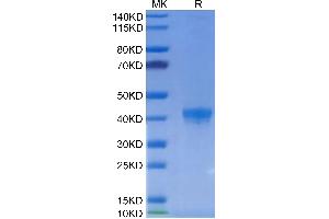 FGL2 Protein (AA 205-439) (His-Avi-DYKDDDDK Tag)