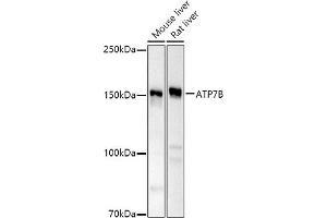 Western blot analysis of extracts of various cell lines, using B antibody (ABIN6127395, ABIN6137355, ABIN6137356 and ABIN6221328) at 1:500 dilution. (ATP7B antibody  (AA 1055-1354))