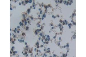 IHC-P analysis of Kidney tissue, with DAB staining. (ITGA2 antibody  (AA 212-370))