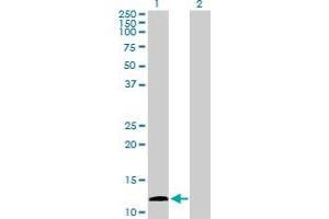 Western Blot analysis of KISS1 expression in transfected 293T cell line by KISS1 MaxPab polyclonal antibody.