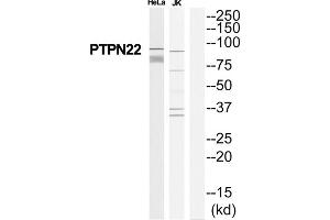 Western Blotting (WB) image for anti-Tyrosine-Protein Phosphatase Non-Receptor Type 22 (PTPN22) (Internal Region) antibody (ABIN1852320)