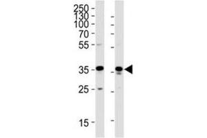 Western blot analysis of lysate from HeLa, HUVEC cell line (left to right) using GAPDH antibody; Ab was diluted at 1:1000 for each lane. (GAPDH antibody  (AA 233-259))