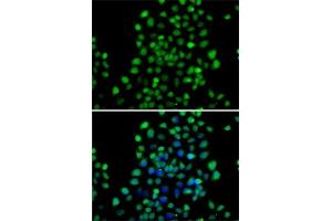 Immunofluorescence analysis of A-549 cells using NTMT1 antibody (ABIN6133076, ABIN6144899, ABIN6144900 and ABIN6222903). (METTL11A antibody  (AA 1-223))