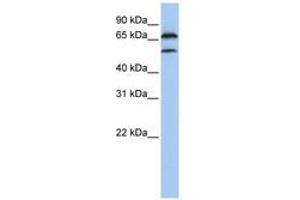 Image no. 1 for anti-F-Box Protein 7 (FBXO7) (C-Term) antibody (ABIN6740800) (FBXO7 antibody  (C-Term))