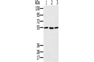 Western Blotting (WB) image for anti-Proteasome (Prosome, Macropain) 26S Subunit, ATPase, 1 (PSMC1) antibody (ABIN2825695) (PSMC1 antibody)