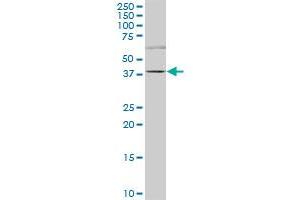 TRIM6-TRIM34 polyclonal antibody (A01), Lot # 060728QCS1. (TRIM6-TRIM34 antibody  (AA 641-740))