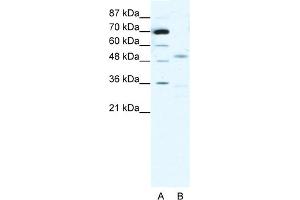 WB Suggested Anti-CHRNG Antibody Titration:  1.