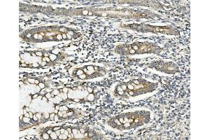 IHC analysis of Methylmalonyl Coenzyme A using anti-Methylmalonyl Coenzyme A antibody (ABIN7603112). (MUT antibody  (N-Term))