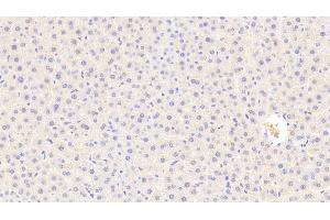 Detection of C5a in Rat Liver Tissue using Polyclonal Antibody to Complement Component 5a (C5a)