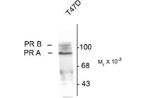 Western blots of whole cell T47D lysate prepared from cells that had been inubated in the presence of the synthetic progestin agonist R5020 (500 nM) showing specific immunolabeling of the ~90k PR-A isoform and the ~120 PR-B isoform of the progesterone receptor phosphorylated at Ser190. (Progesterone Receptor antibody  (pSer190))
