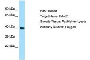 Image no. 1 for anti-Programmed Cell Death 2 (PDCD2) (AA 91-140) antibody (ABIN6749809) (PDCD2 antibody  (AA 91-140))