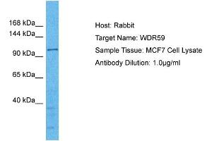 Host: Rabbit Target Name: WDR59 Sample Type: MCF7 Whole Cell lysates Antibody Dilution: 1. (WDR59 antibody  (C-Term))