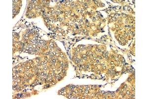 IHC analysis of GM130 using anti-GM130 antibody (ABIN6719432). (Golgin A2 (GOLGA2) (AA 796-913) antibody)