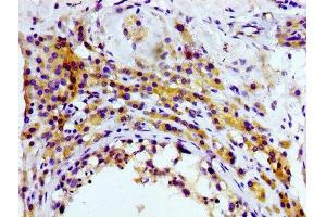 Immunohistochemistry (IHC) image for anti-CD81 (CD81) antibody (ABIN7127284)