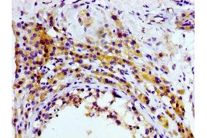 IHC image of ABIN7127284 diluted at 1:100 and staining in paraffin-embedded human testis tissue performed on a Leica BondTM system.
