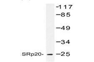 Image no. 1 for anti-serine/arginine-Rich Splicing Factor 3 (SRSF3) antibody (ABIN317610) (SRSF3 antibody)