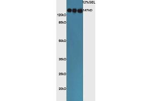 Lane 1: mouse lung lysates Lane 2: mouse liver lysates, Lane 3: mouse adrenal lysates probed with Rabbit Rabbit Anti-ACE Polyclonal Antibody, Unconjugated  at 1:5000 for 90 min at 37˚C. (Angiotensin I Converting Enzyme 1 antibody  (AA 801-900))