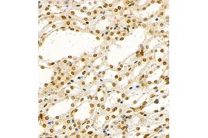 Immunohistochemistry (Paraffin-embedded Sections) (IHC (p)) image for anti-Transcription Factor 7 (T-Cell Specific, HMG-Box) (TCF7) antibody (ABIN7075952)