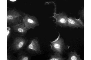 Immunofluorescent staining of U2OS (ATCC HTB-96) cells. (FAK antibody  (AA 354-533))