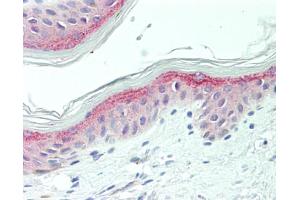 Human Skin: Formalin-Fixed, Paraffin-Embedded (FFPE) (NG2 antibody  (AA 1919-2258))