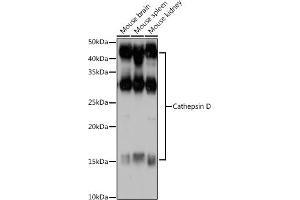 Western blot analysis of extracts of various cell lines, using Cathepsin D antibody (ABIN6127553, ABIN6139223, ABIN6139224 and ABIN6217233) at 1:1000 dilution. (Cathepsin D antibody  (AA 65-412))