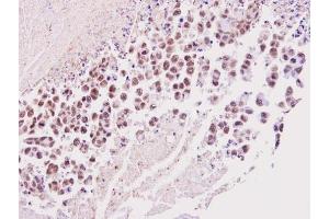 IHC-P Image Immunohistochemical analysis of paraffin-embedded SNU16 xenograft, using TIMELESS, antibody at 1:100 dilution. (TIMELESS antibody  (N-Term))