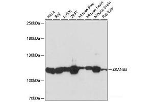 Western blot analysis of extracts of various cell lines using ZRANB3 Polyclonal Antibody at dilution of 1:3000. (ZRANB3 antibody)