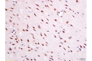 paraformaldehyde-fixed, paraffin embedded mouse brain tissue; Antigen retrieval by boiling in sodium citrate buffer(pH6) for 15min; Block endogenous peroxidase by 3% hydrogen peroxide for 30 minutes; Blocking buffer (normal goat serum) at 37°C for 20min; Antibody incubation with Rabbit Anti-QRFP Polyclonal Antibody, Unconjugated  at 1:200 overnight at 4°C, followed by a conjugated secondary and DAB staining (Neuropeptide antibody  (AA 91-133))