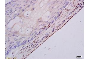 Formalin-fixed and paraffin embedded rat ovary labeled with Anti MSH3 Polyclonal Antibody, Unconjugated (ABIN1387851) at 1:200 followed by conjugation to the secondary antibody and DAB staining