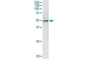 Immunoprecipitation of WAPAL transfected lysate using anti-WAPAL monoclonal antibody and Protein A Magnetic Bead , and immunoblotted with WAPAL monoclonal antibody. (WAPAL antibody  (AA 1-402))