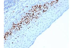 Formalin-fixed, paraffin-embedded human Skin stained with Ki67 Mouse Monoclonal Antibody (MKI67/2463).