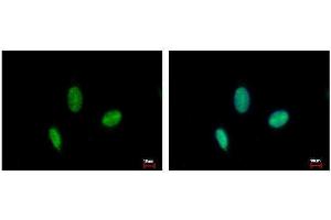 ICC/IF Image RAD23B antibody detects RAD23B protein at nucleus by immunofluorescent analysis. (RAD23B antibody  (Center))