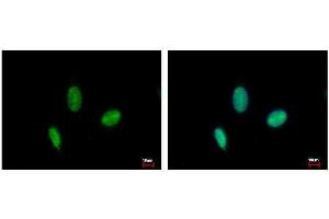 ICC/IF Image RAD23B antibody detects RAD23B protein at nucleus by immunofluorescent analysis.