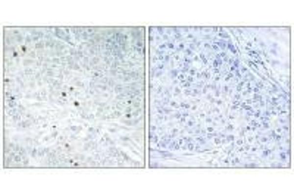 TP53INP2 antibody