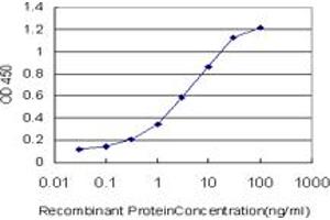 Detection limit for recombinant GST tagged IRAK4 is approximately 0. (IRAK4 antibody  (AA 1-130))