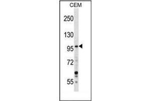 Western blot analysis of GREB1 Antibody  in CEM cell line lysates (35ug/lane). (GREB1 antibody  (Middle Region))