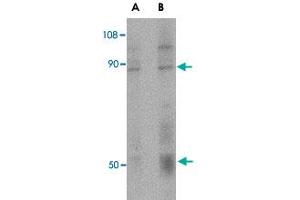 Western blot analysis of CD248 in human colon tissue lysate with CD248 polyclonal antibody  at (A) 0. (CD248 antibody  (C-Term))