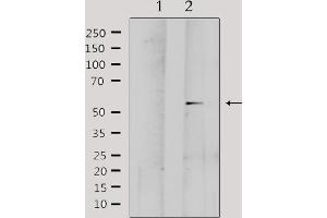 Western blot analysis of extracts from Hela, using MMP1 Antibody. (MMP1 antibody  (C-Term))