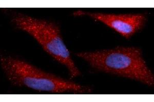 Immunofluorescence (IF) image for anti-Immunoglobulin Binding Protein (BIP) (AA 20-650) antibody (APC) (ABIN5566439) (BIP antibody  (AA 20-650) (APC))