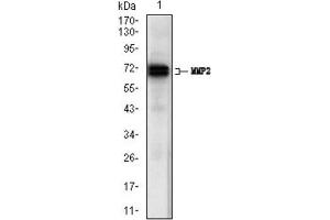 Western Blotting (WB) image for anti-Matrix Metalloproteinase 2 (MMP2) (AA 242-396) antibody (ABIN1844833)
