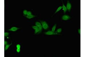 Immunofluorescent analysis of Hela cells using ABIN7148503 at dilution of 1:100 and Alexa Fluor 488-congugated AffiniPure Goat Anti-Rabbit IgG(H+L) (COPS7B antibody  (AA 1-157))