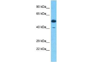 Host:  Rabbit  Target Name:  SERPINB3  Sample Type:  Thymus Tumor lysates  Antibody Dilution:  1.