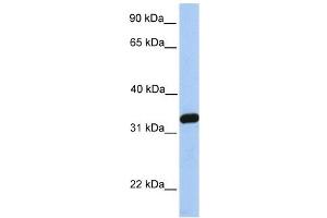 NKIRAS2 antibody used at 1 ug/ml to detect target protein. (NKIRAS2 antibody  (C-Term))