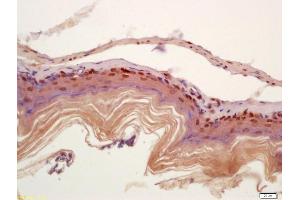 Formalin-fixed and paraffin embedded mouse stomach wall labeled with Anti-CIDEC Polyclonal Antibody, Unconjugated (ABIN872596) at 1:200 followed by conjugation to the secondary antibody and DAB staining (CIDEC antibody  (AA 101-200))