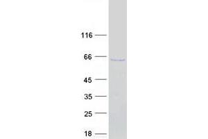 Validation with Western Blot (IRF5 Protein (Transcript Variant 1) (Myc-DYKDDDDK Tag))