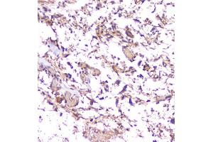 IHC-P: Amyloid beta antibody testing of mouse brain tissue. (APP antibody  (C-Term))